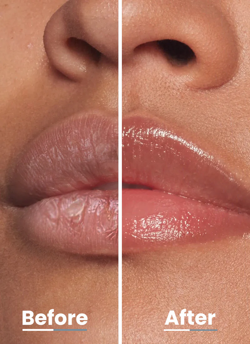 BRIGHTENING LIP BALM SPF30 - 2% KOJIC ACID, VITAMIN C & 1% VITAMIN E - 10G - Image 5