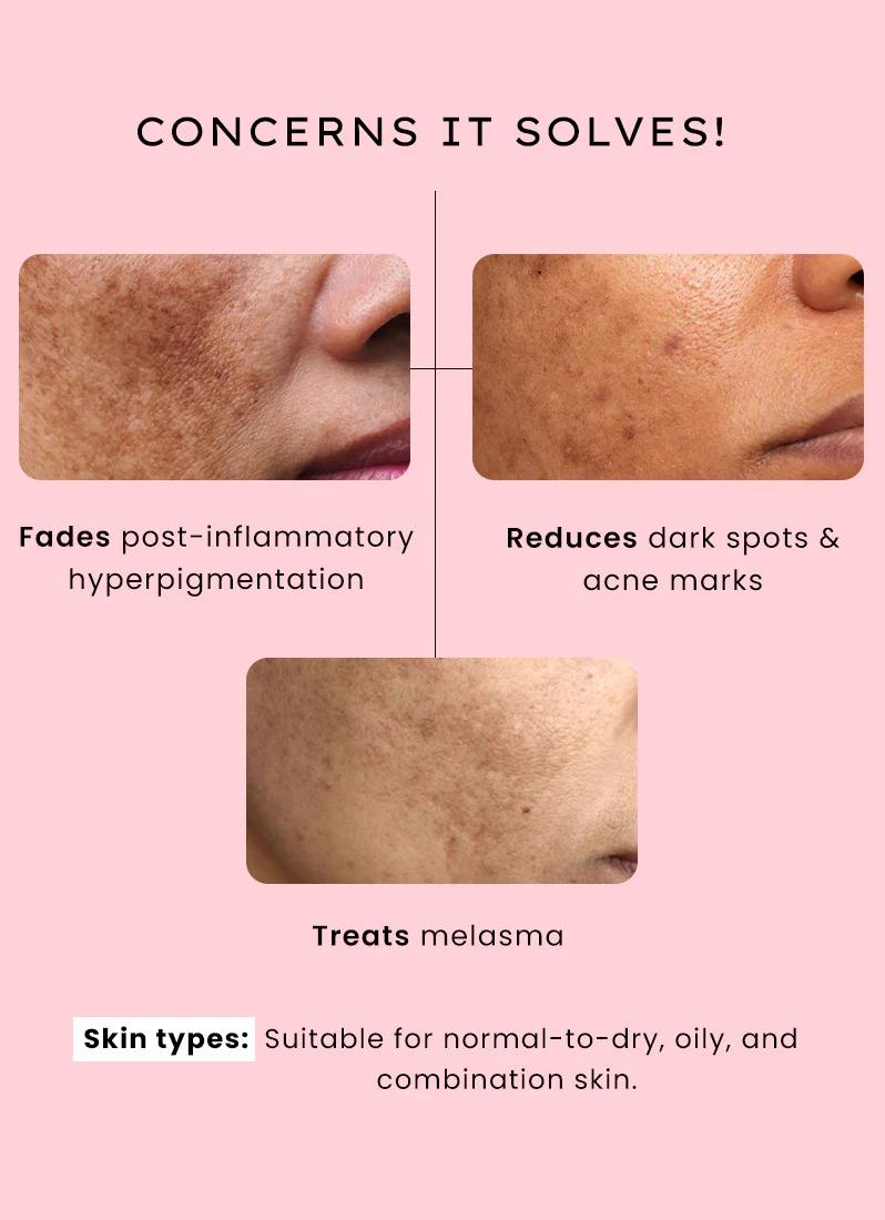 Dual Phase De-pigmentation Serum | 4% Tranexamic Acid- 30ml - Image 9